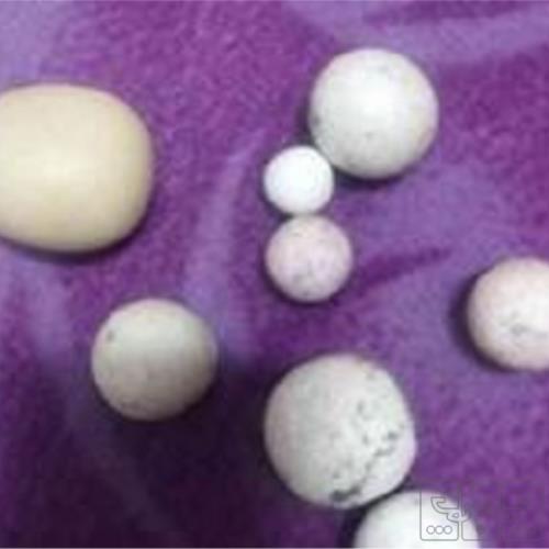 آرایشی، بهداشتی و سلامت - زیورآلات - سنگ های قیمتی و نیمه قیمتی